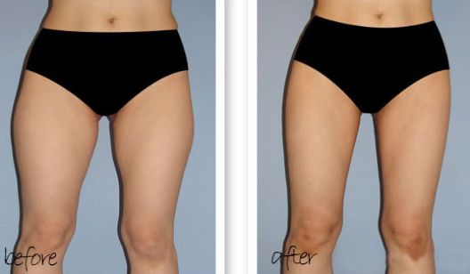 南京哪家醫(yī)院除雀斑好？醫(yī)院雀斑治療排名及效果對(duì)比！