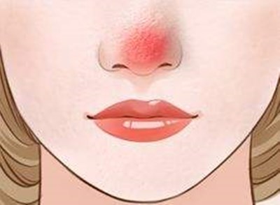 上海九院哪位醫(yī)生做雙眼皮技術(shù)好？?jī)r(jià)格如何？附帶成功案例分析