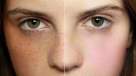 2023蕪湖光子嫩膚改善皮膚權(quán)威醫(yī)生口碑前10位(田軍、冀偉濤、雷中元更有保障！)