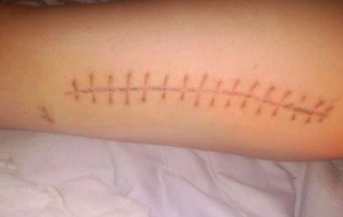 水光針武漢三甲醫(yī)院哪家好？如何選擇適合自己的水光針?lè)?wù)醫(yī)院