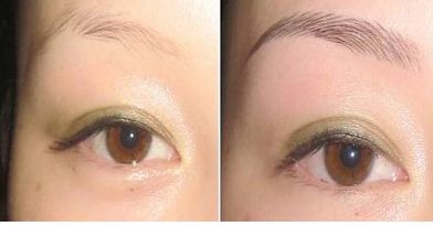 湖北哪家醫(yī)院治療團(tuán)結(jié)口好呢？