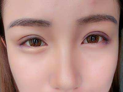 2023合肥魚尾紋專家評價TOP10強(羅定安、劉家賀、朱凡口碑價格出爐)