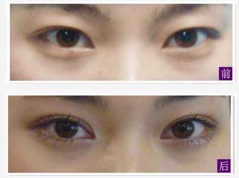 求推薦南寧哪家整形醫(yī)院好？讓你輕松找到靠譜的整容醫(yī)院