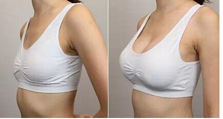 廣州脂肪隆胸醫(yī)生技術(shù)高超，手術(shù)效果自然倍受贊譽(yù)