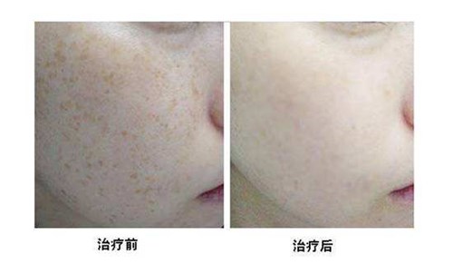 2023西昌專業(yè)腿部吸脂減肥手術正規(guī)專家口碑前十位(湯穎峰、吳強、劉光毓好評合集推薦)