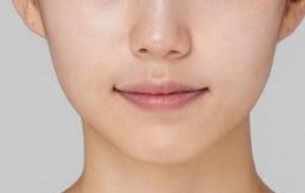 2023濟(jì)南膠原蛋白注射墊額頭醫(yī)生排名榜top10強(qiáng)(平金磊、黃志祥、王玉柱干貨帖收藏)