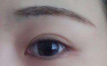 【2023年最新】鄭州哪家雙眼皮醫(yī)院口碑好、技術(shù)高？！