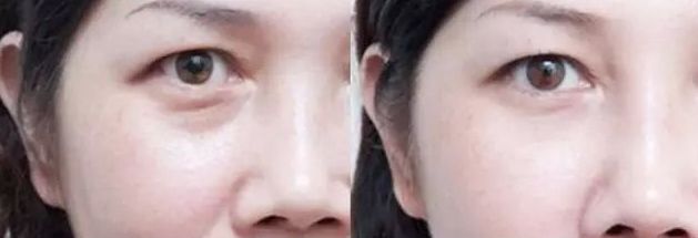 保定市整形外科哪家好？2023年最新榜單及專家推薦！