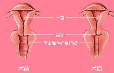 長沙靠譜矯正醫(yī)院哪家好？解答你所有的疑慮！