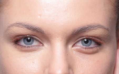 深圳哪家醫(yī)院的埋線減肥效果最好？