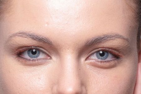 成都有哪些專業(yè)的祛斑祛痘印機(jī)構(gòu)值得推薦？