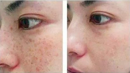 包頭哪家醫(yī)院做隆胸好？全面解析包頭市評價最高的隆胸醫(yī)院