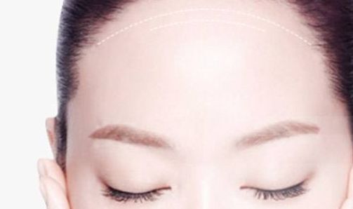 南京做修復(fù)雙眼皮哪家好？解析南京修復(fù)雙眼皮的最佳選擇