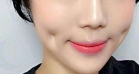 上海超聲刀哪家醫(yī)院做得好？專家推薦，超聲刀手術(shù)最佳選擇