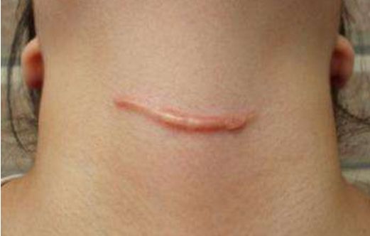 衡陽去痘坑哪家醫(yī)院好？-衡陽市專業(yè)祛痘修復(fù)醫(yī)院排行榜