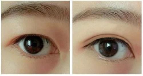 2023秦皇島深藍射頻面部排行前十強的醫(yī)生(王強、劉運濤、池建強推薦指數(shù)五顆星)