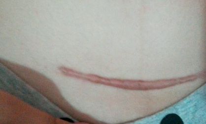 南京激光祛皺紋哪家醫(yī)院好？探尋南京最受歡迎的激光祛皺紋醫(yī)院