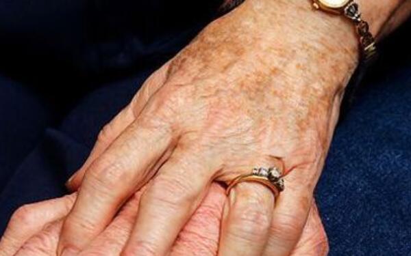 廣州曙光醫(yī)學(xué)美容醫(yī)院Charles假體豐胸術(shù)成果如何？