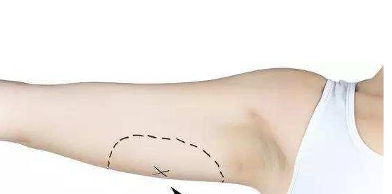 南京去除黃褐斑醫(yī)院排名及口碑，哪家值得信賴(lài)？