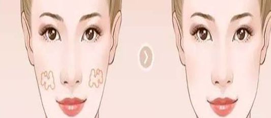 南京哪家醫(yī)院的小陰唇整形效果好？