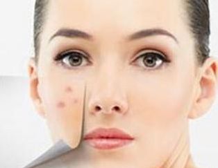 廈門哪家醫(yī)院墊鼻子好？專家推薦的Top5廈門墊鼻子好醫(yī)院