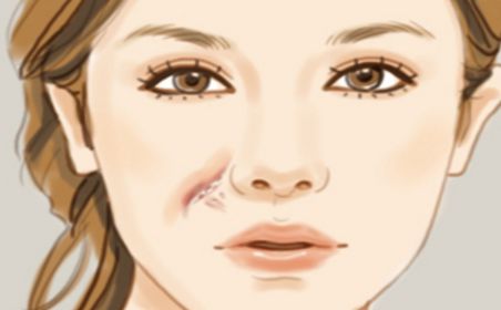 天津有哪些醫(yī)院的祛痘效果好？哪家醫(yī)院的祛痘效果最佳？