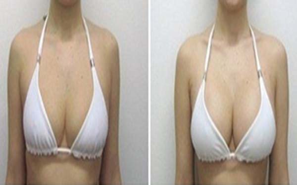 2023西安電波拉皮去蝴蝶斑專家排行榜前十(王瑞、盧丙侖、王曉鵬上榜的都是高人氣醫(yī)生列表！)