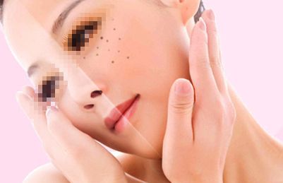 上海哪家專(zhuān)業(yè)醫(yī)院消除眼袋好