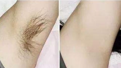 杭州藝星徐利剛醫(yī)生隆鼻項(xiàng)目靠譜嗎？技術(shù)操作曝光，口碑如何？