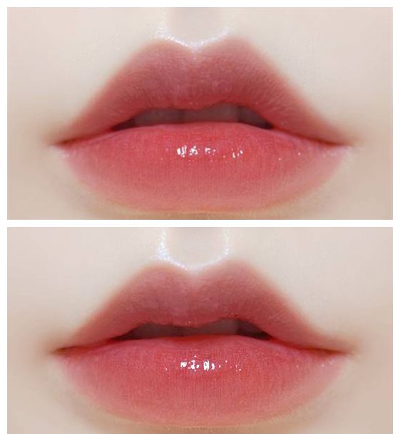 揭秘上海注射玻尿酸醫(yī)院排行榜，哪家好的口碑最高？