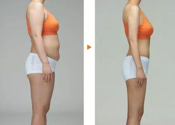 常州去胎記哪家醫(yī)院好？專(zhuān)家推薦常州哪家醫(yī)院胎記治療效果好