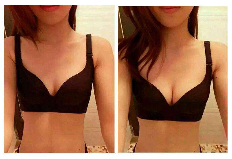 2023邯鄲干細胞口周紋填充排名榜專家(戴晨、柳龍春、張成元正規(guī)專家推送！)