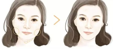 上海哪家下頜骨醫(yī)院好？解析上海下頜骨疾病常見病例及專業(yè)治療！