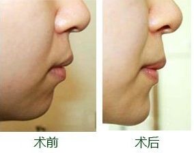 南寧整形豐胸醫(yī)院排名及評價(jià)互動(dòng)：哪家醫(yī)院效果更好？