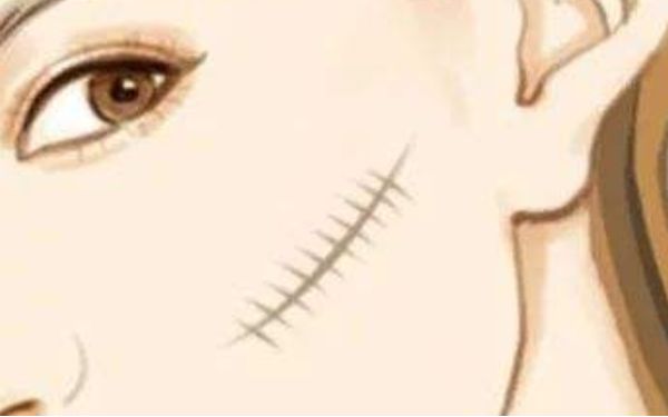 廣州康華清醫(yī)療美容門診部醫(yī)生有哪些擅長項目？醫(yī)院技術(shù)一覽如何？