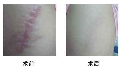 2023衡陽面部削骨專家前10口碑排名(廖偉龍、石紅梅、方玉蓉口碑反饋持續(xù)更新)