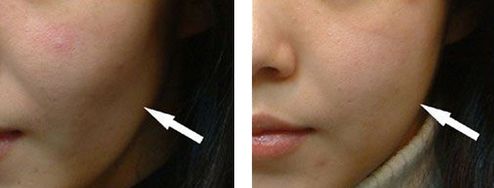 邯鄲美容整形醫(yī)院哪家好？專業(yè)品質(zhì)口碑贊譽醫(yī)院推薦！