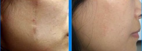 常州拇外翻醫(yī)院哪家醫(yī)院好？專家推薦，附詳細(xì)排名和患者口碑評論