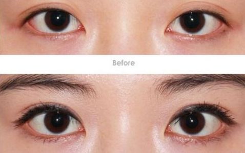 淮安瘦臉針哪家技術(shù)好？探究淮安市臉部瘦臉針技術(shù)領(lǐng)先的醫(yī)療機(jī)構(gòu)