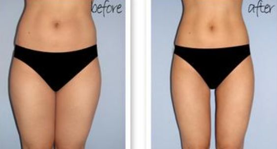 2023臨沂E光祛除動態(tài)細紋正規(guī)醫(yī)生評價前幾(吳鵬、李義、杜蘭余實力價格公開)