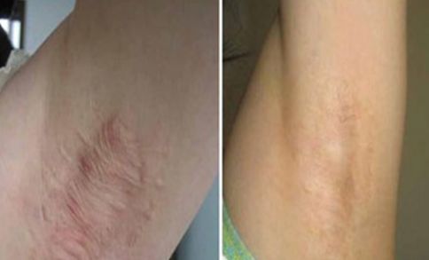 廈門祛雀斑醫(yī)院排名及口碑，哪家好？