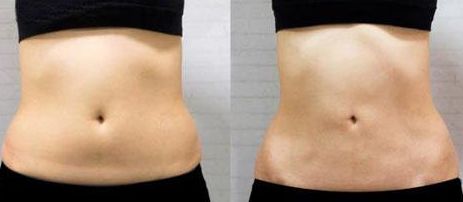 上海疤痕科醫(yī)院哪家好？綜合評測2023，含專家問答與真實患者見證