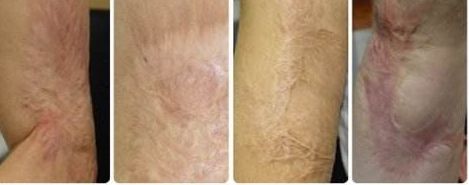 南京去紅血絲醫(yī)院專業(yè)推薦：哪家醫(yī)院技術高效、費用合理？