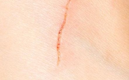 深圳去眼袋醫(yī)院哪家技術(shù)先進，效果好