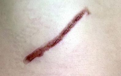 探尋開封市美容醫(yī)院的排名與口碑，哪家值得信賴？