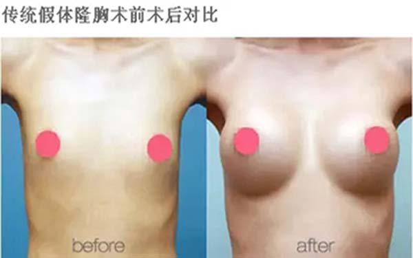 溫州雍禾醫(yī)院信譽(yù)如何？求推薦占家佳醫(yī)生植發(fā)效果如何？或溫州雍禾醫(yī)院口碑怎么樣？哪位醫(yī)生適合占家佳植發(fā)