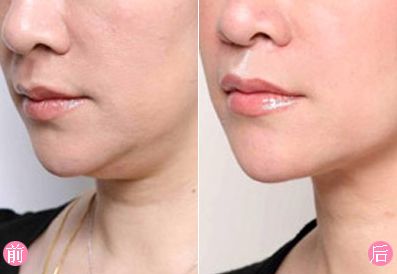 瀘州去疤痕哪家醫(yī)院好？疤痕修復(fù)盡在XXX專科醫(yī)院！