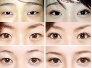 武漢去眼袋哪家好可信？揭秘眼袋整形專家推薦排行榜！