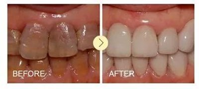 西安畫美楊萬忠鼻部整形效果解析！楊萬忠醫(yī)生簡介及收費準(zhǔn)則！