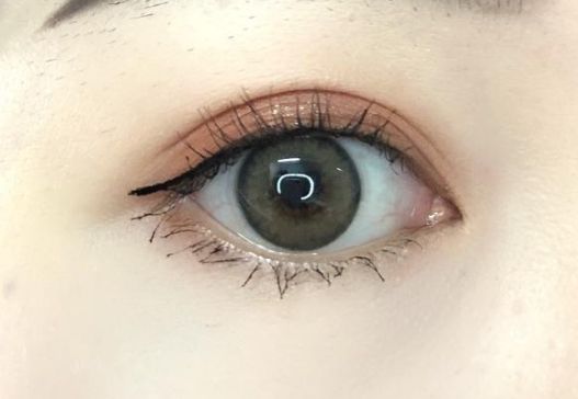 重慶去疤痕醫(yī)院有哪些專家？哪家去疤痕醫(yī)院好？